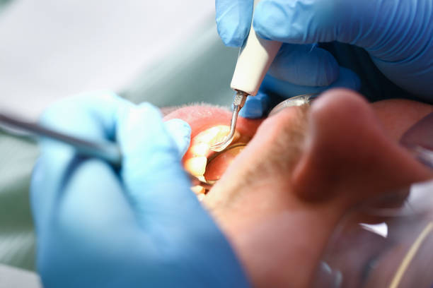 Best Emergency Dental Services for Seniors in Toulon, IL