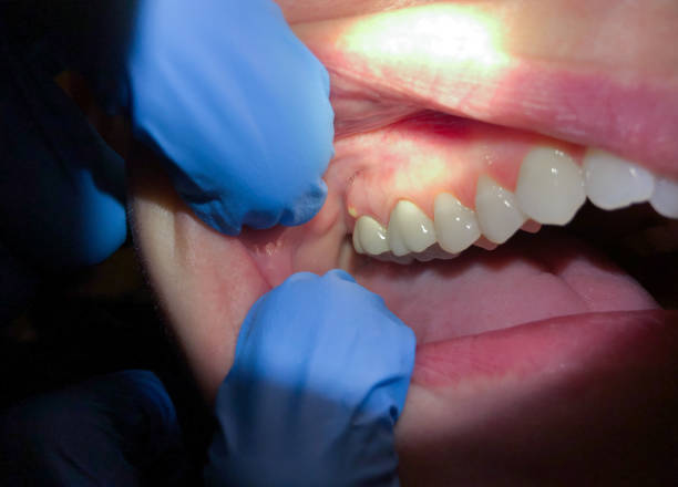 Best Emergency Cosmetic Dentistry in Toulon, IL