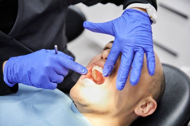 Best Broken or Cracked Tooth Emergency Dentist in Toulon, IL